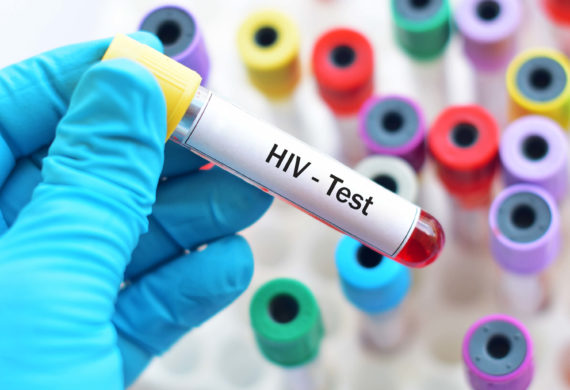 HIV_testing_services