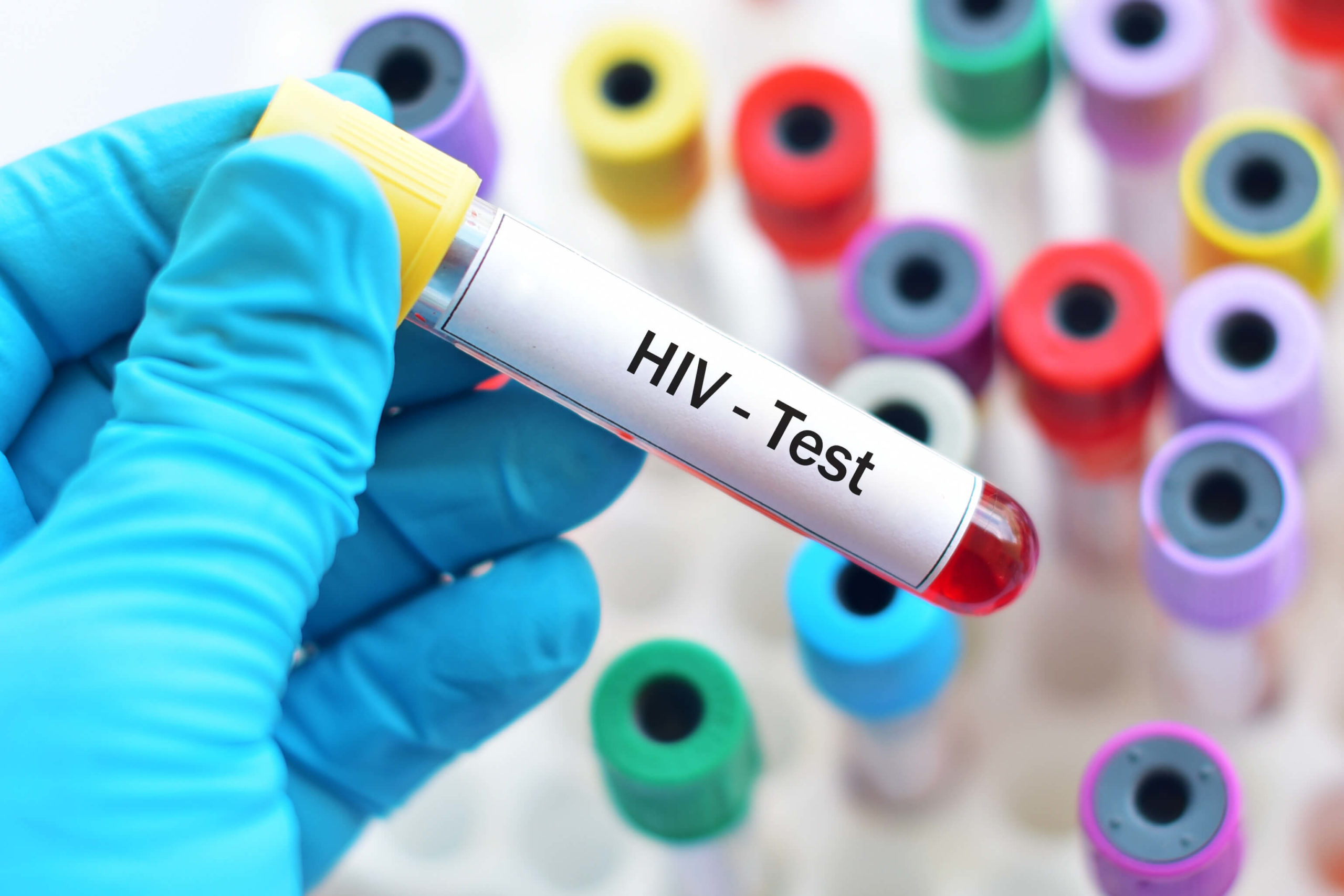 testing for hiv stds        <h3 class=